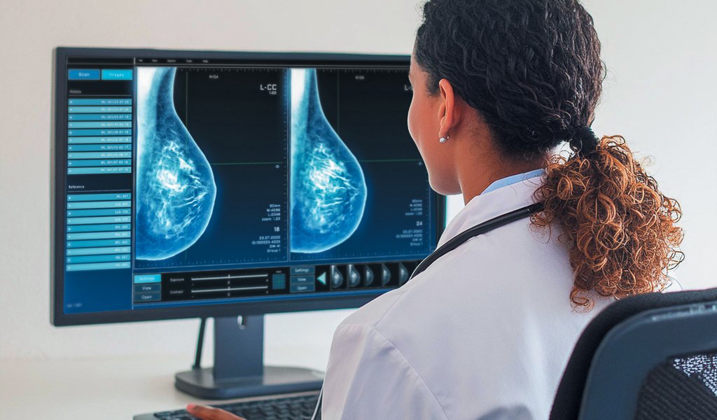 Chesterfield Royal Hospital is currently trialling the “Kheiron Mia” breast screening AI diagnostic service.