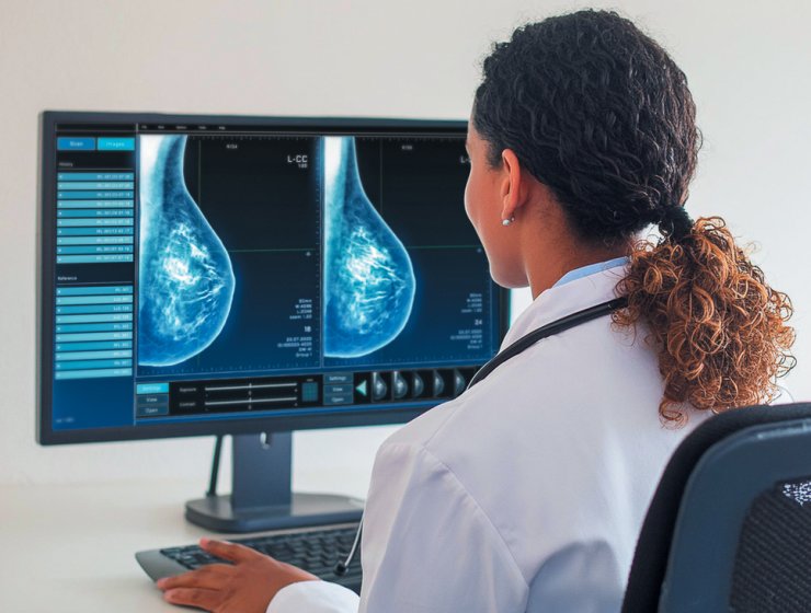 Chesterfield Royal Hospital is currently trialling the “Kheiron Mia” breast screening AI diagnostic service.